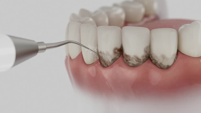 Reliable Dental Implants contractor in Oregon, WI by Smile Center Dentistry